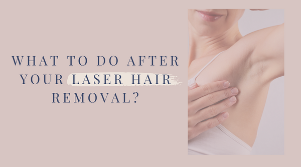 What to do after your laser hair removal?