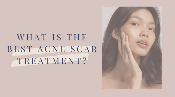 What Is the Best Acne Scar Treatment?