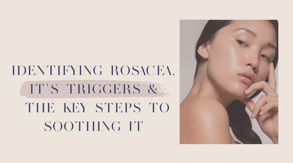 Identifying Rosacea, it's triggers and the key steps to soothing it