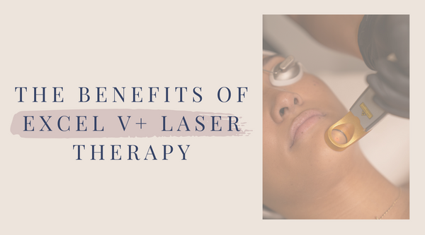 The Benefits of Excel V+ Laser Treatment