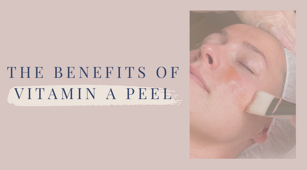 The Transformative Effects of Vitamin A Peel